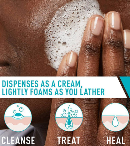Acne Foaming Cream Cleanser
